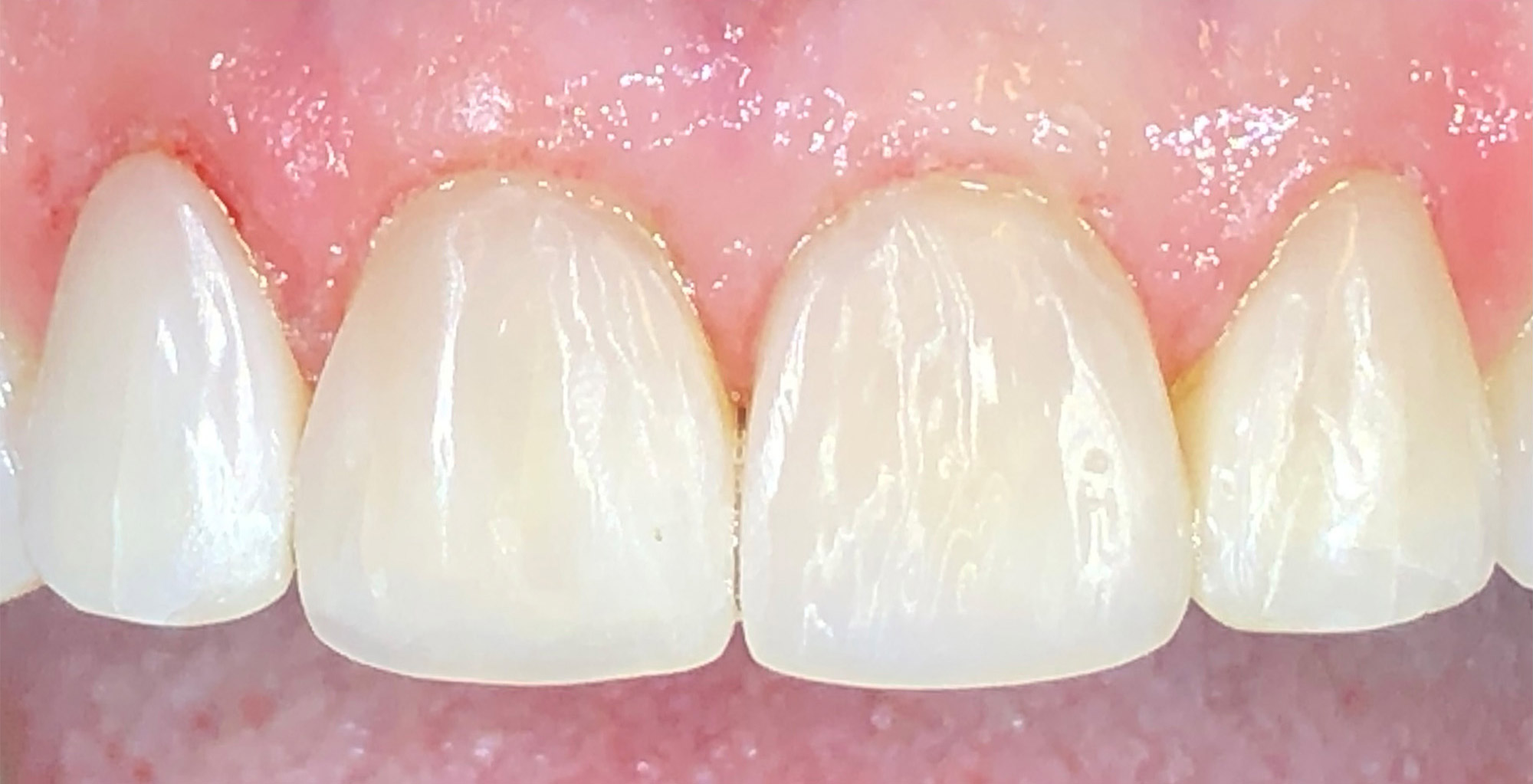 After image