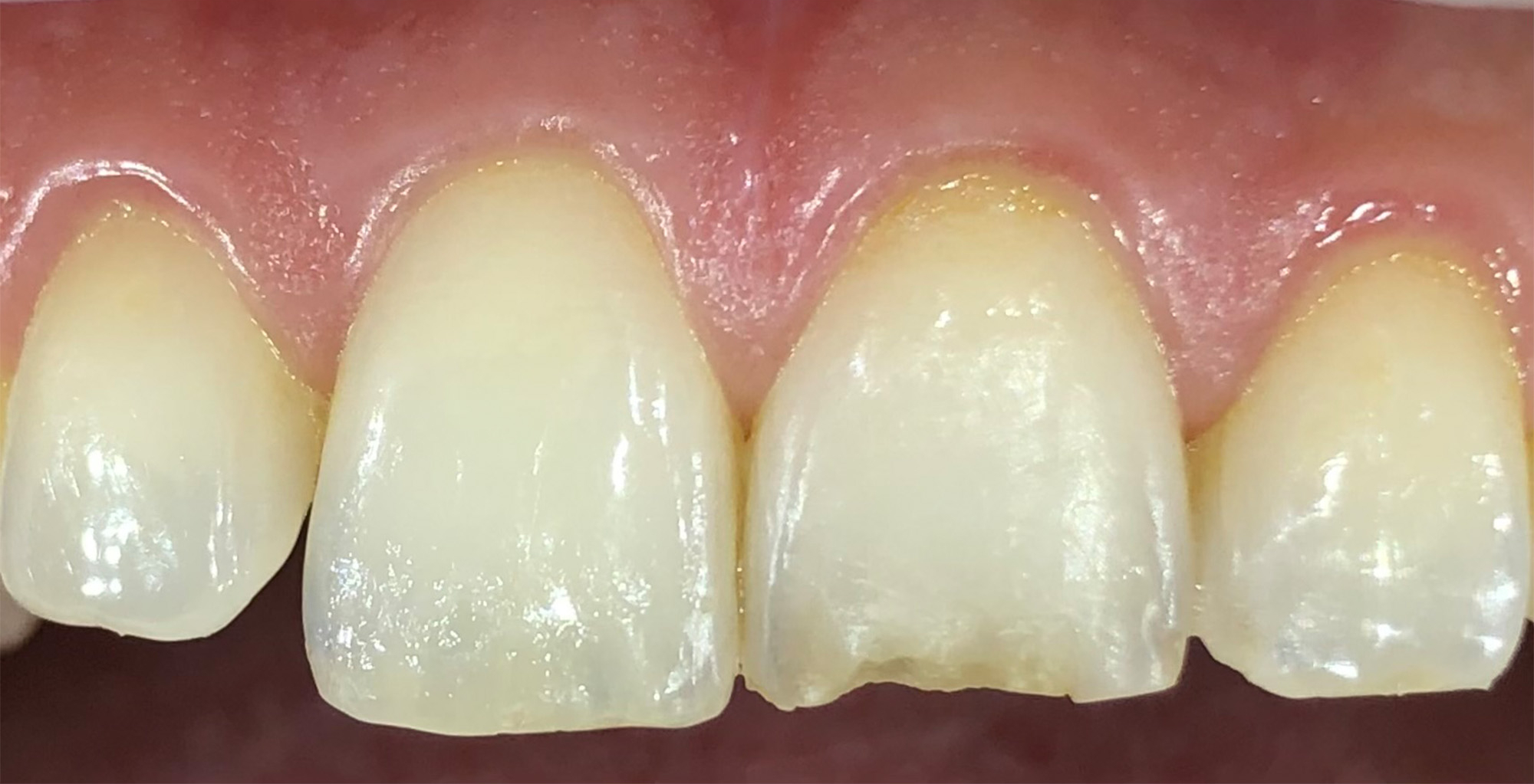 Before image