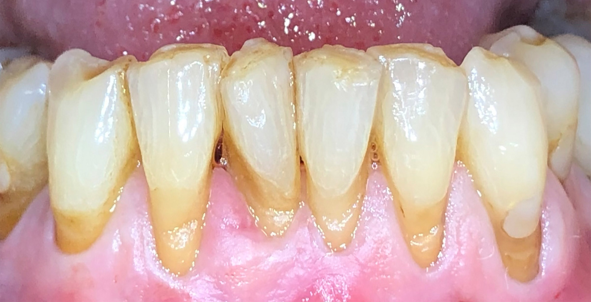 Before image