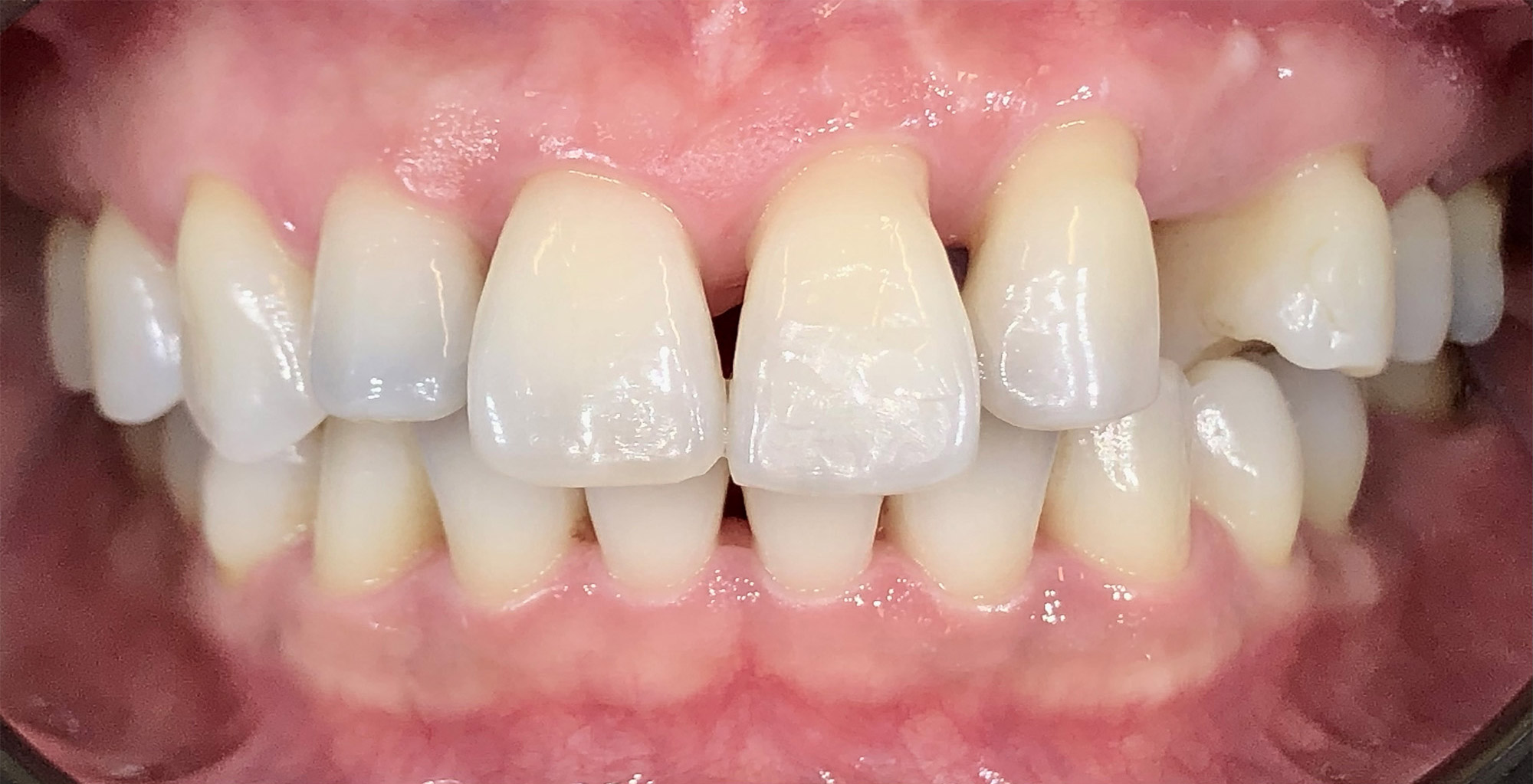 Before image