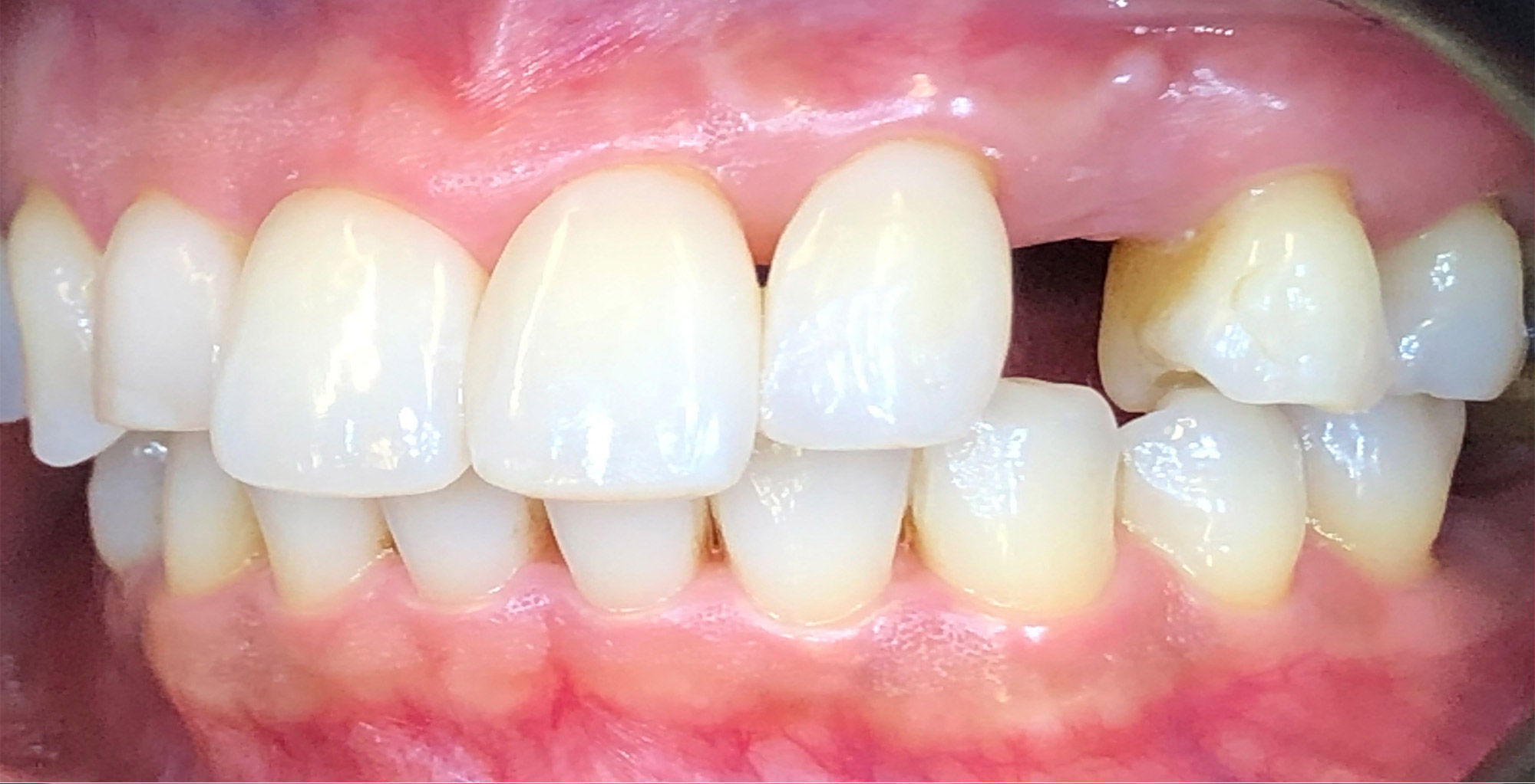Before image
