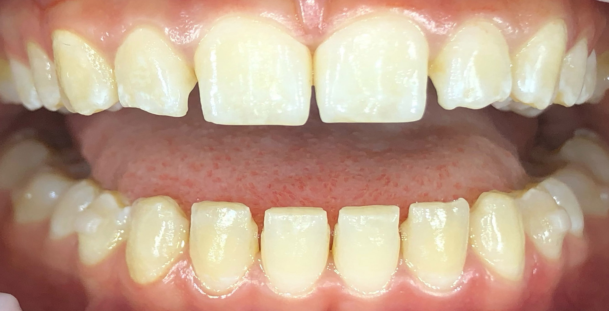 Before image
