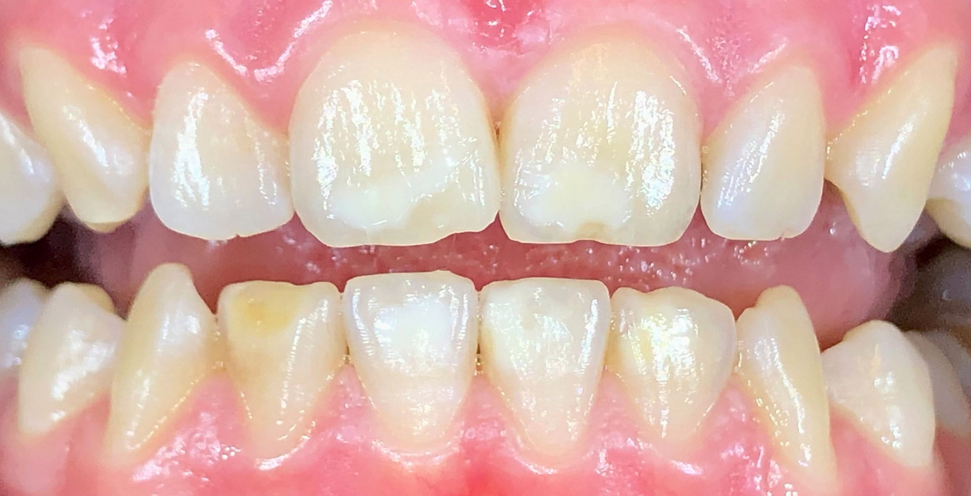 Before image